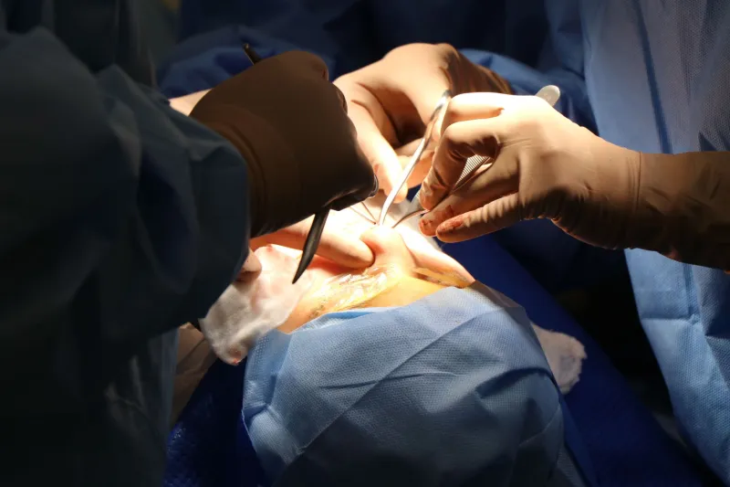 Reusable Surgical Drapes: What Hospitals Aren't Telling You About the Fabric Between You and Infection